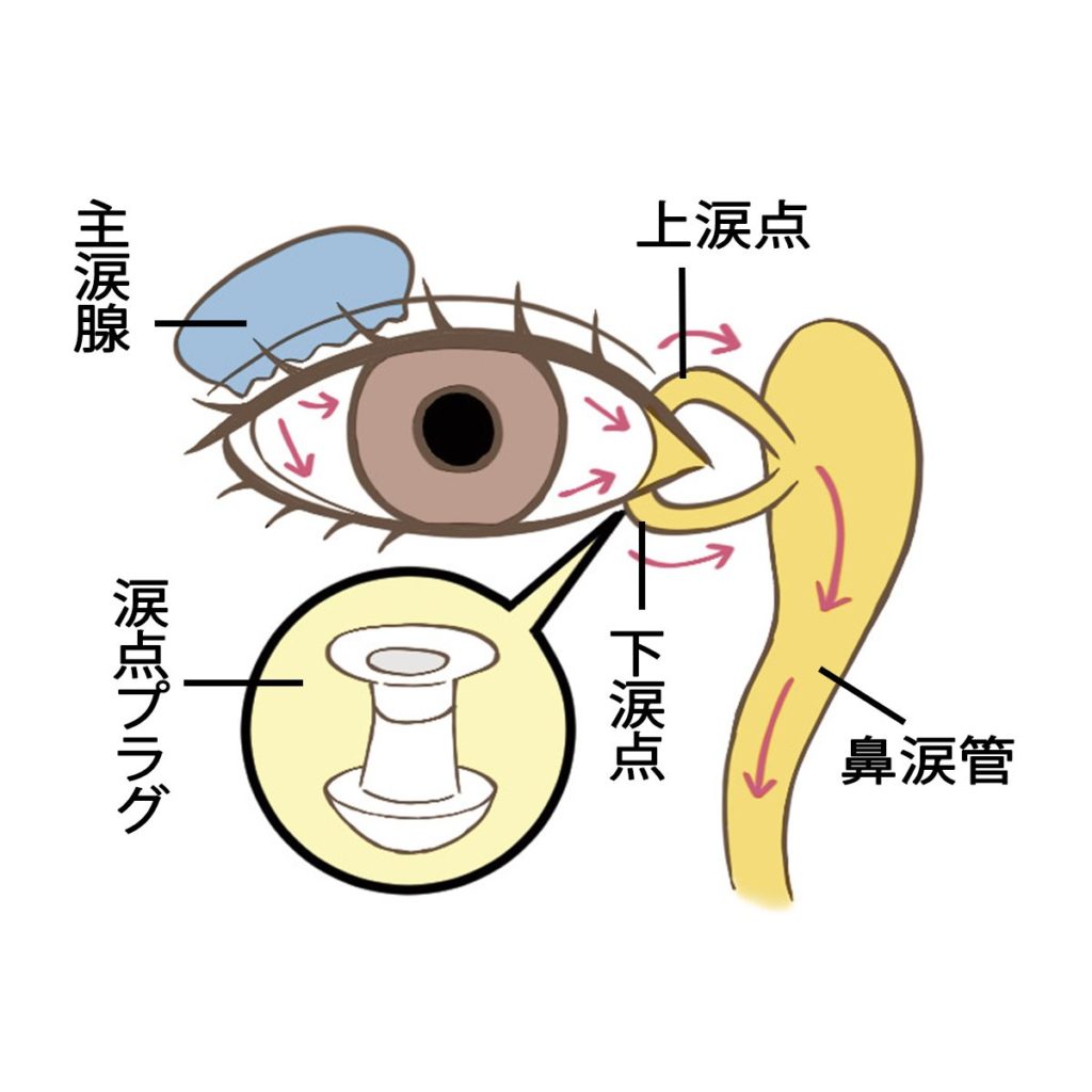 画像に alt 属性が指定されていません。ファイル名: 【ドライアイ】原因や症状は？-目の潤いを守るための対策8-1024x1024.jpg